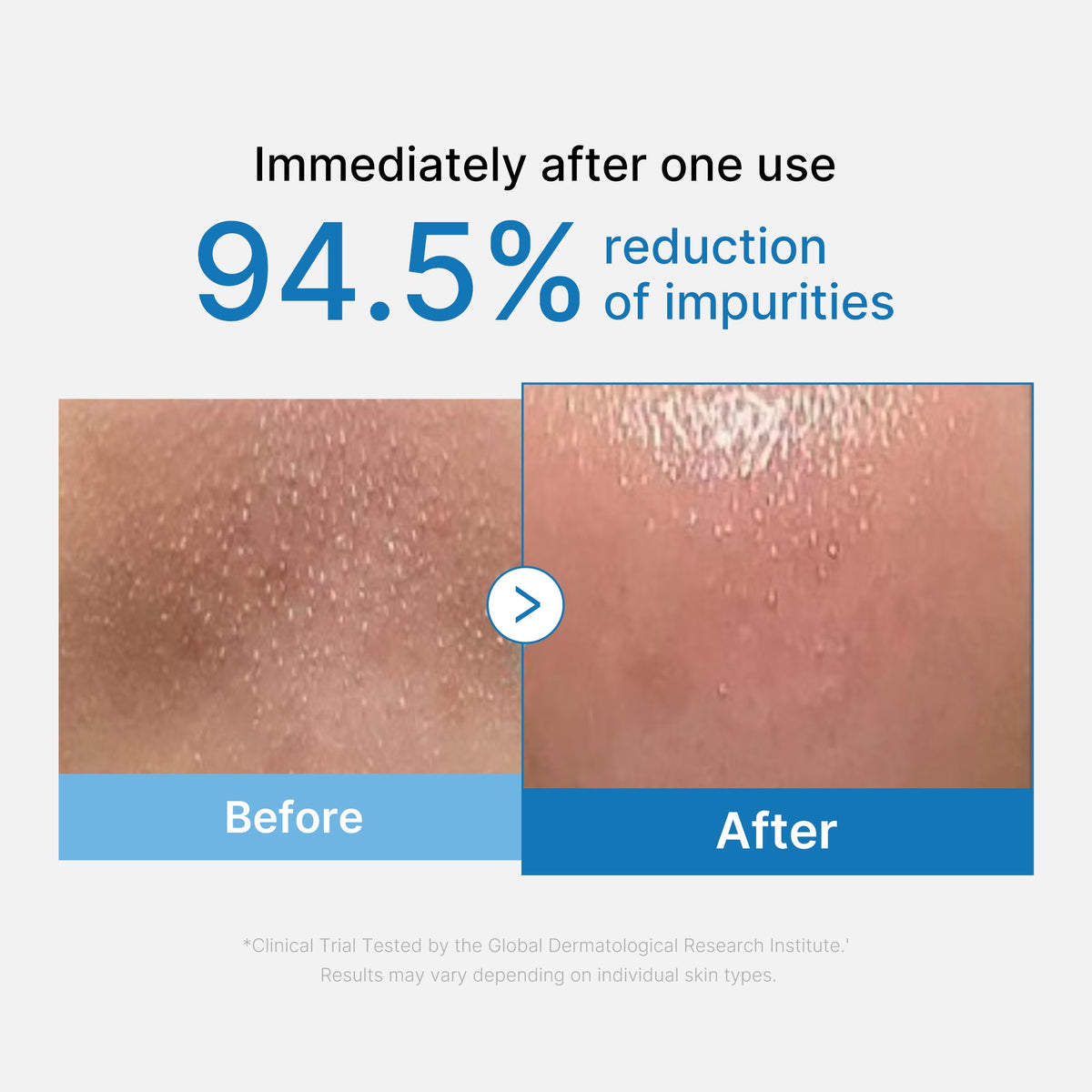 Zero Pore Blackhead Deep Cleansing Oil P5