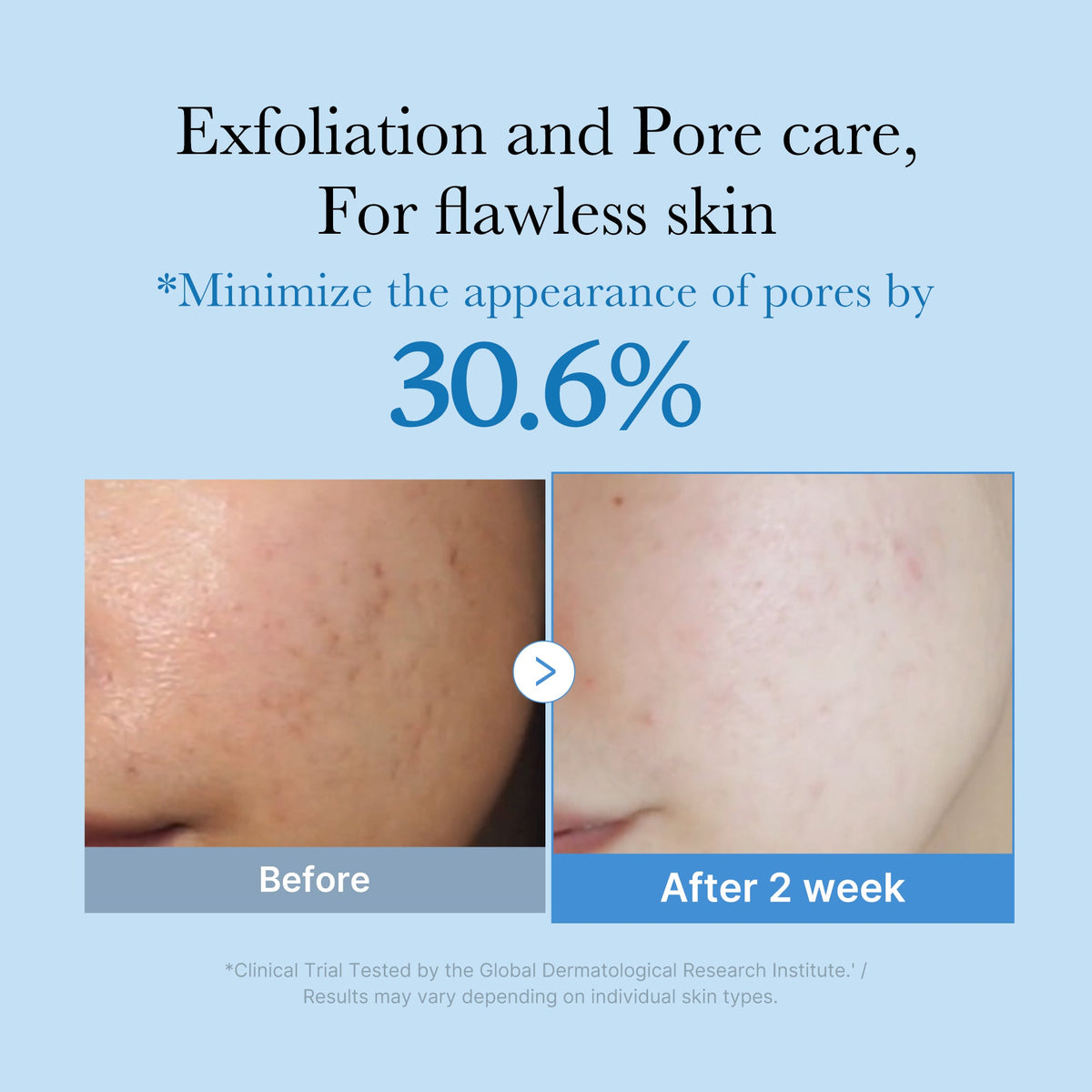 Zero Pore Toner J5
