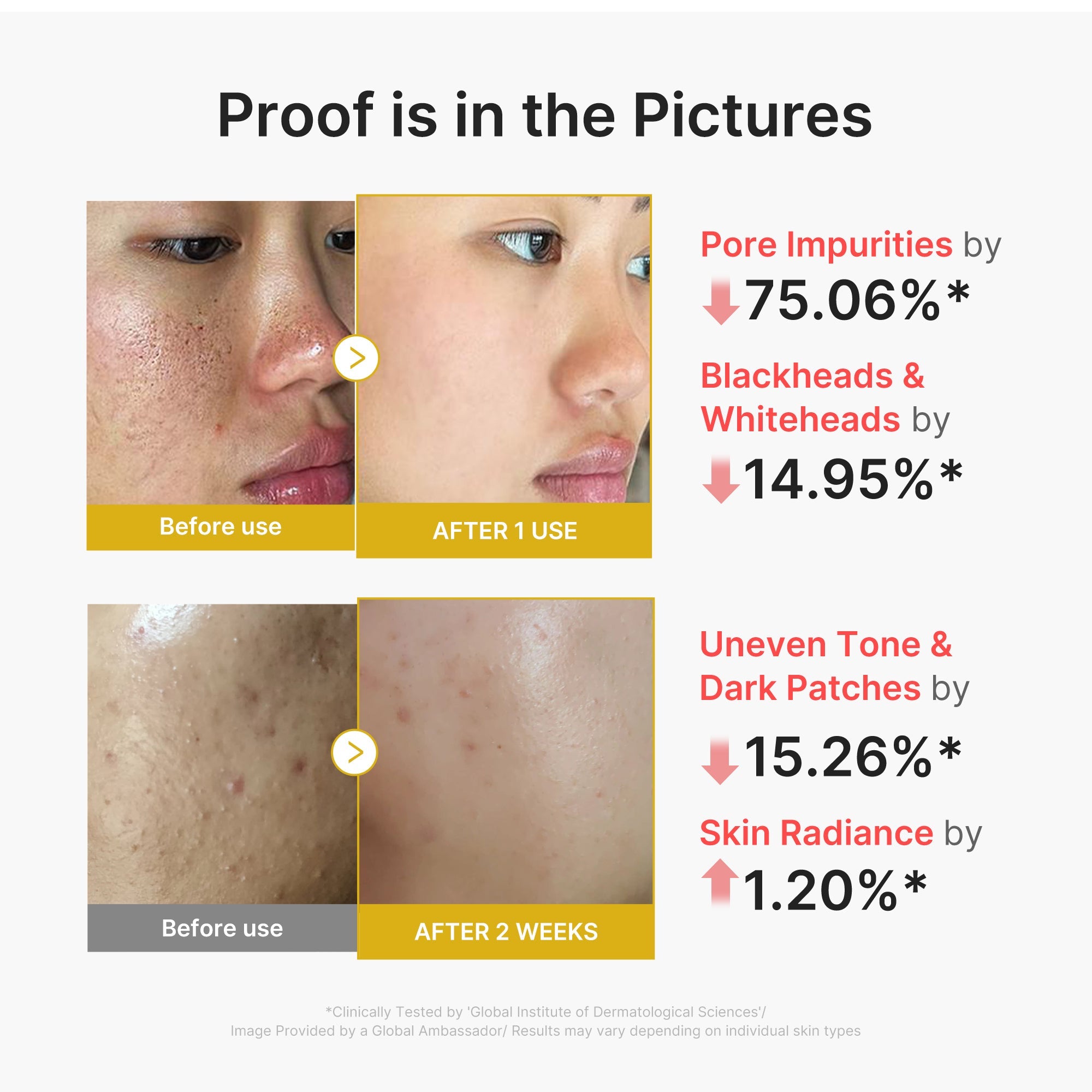 Kojic Acid Turmeric Peel Shot B4