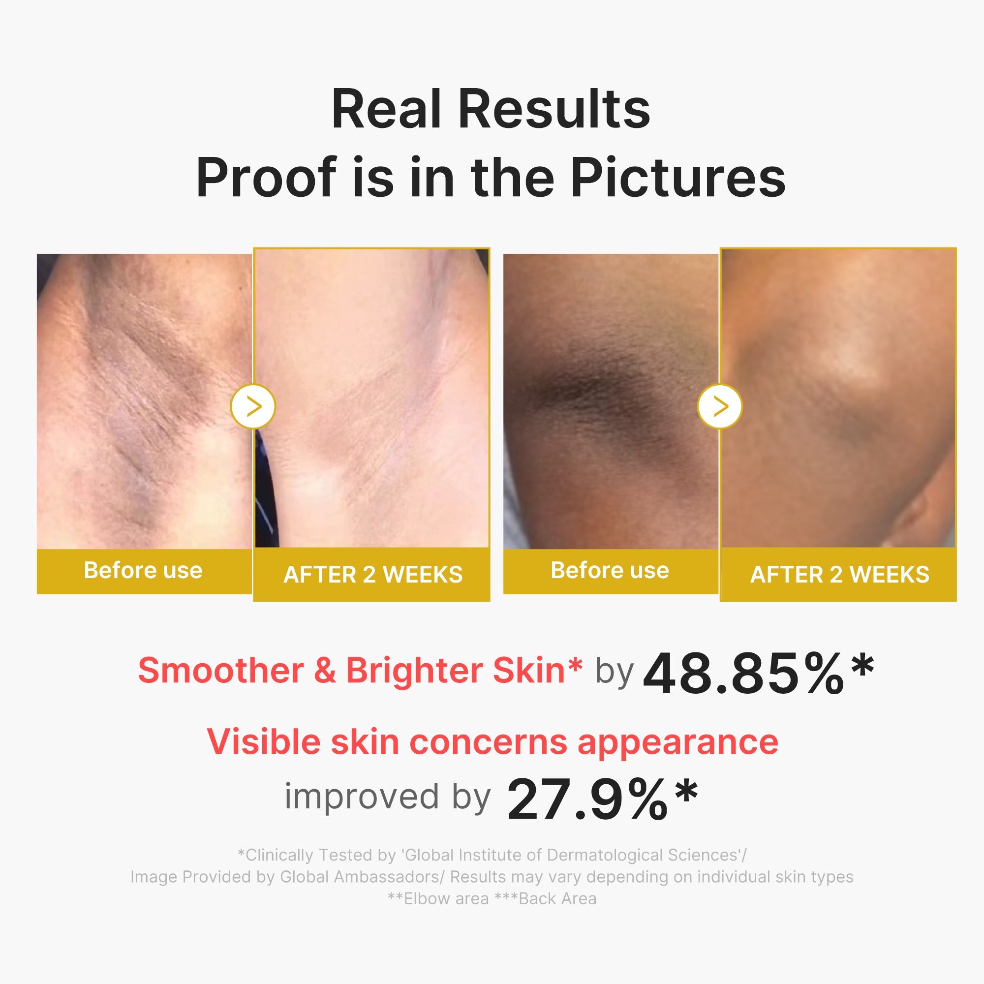 Kojic Acid Turmeric Body Peel Shot R0