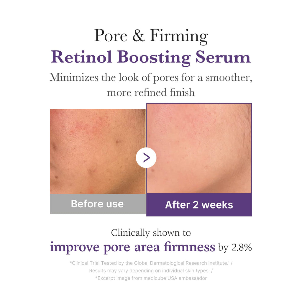 Retinol NMN Boosting Serum Y8