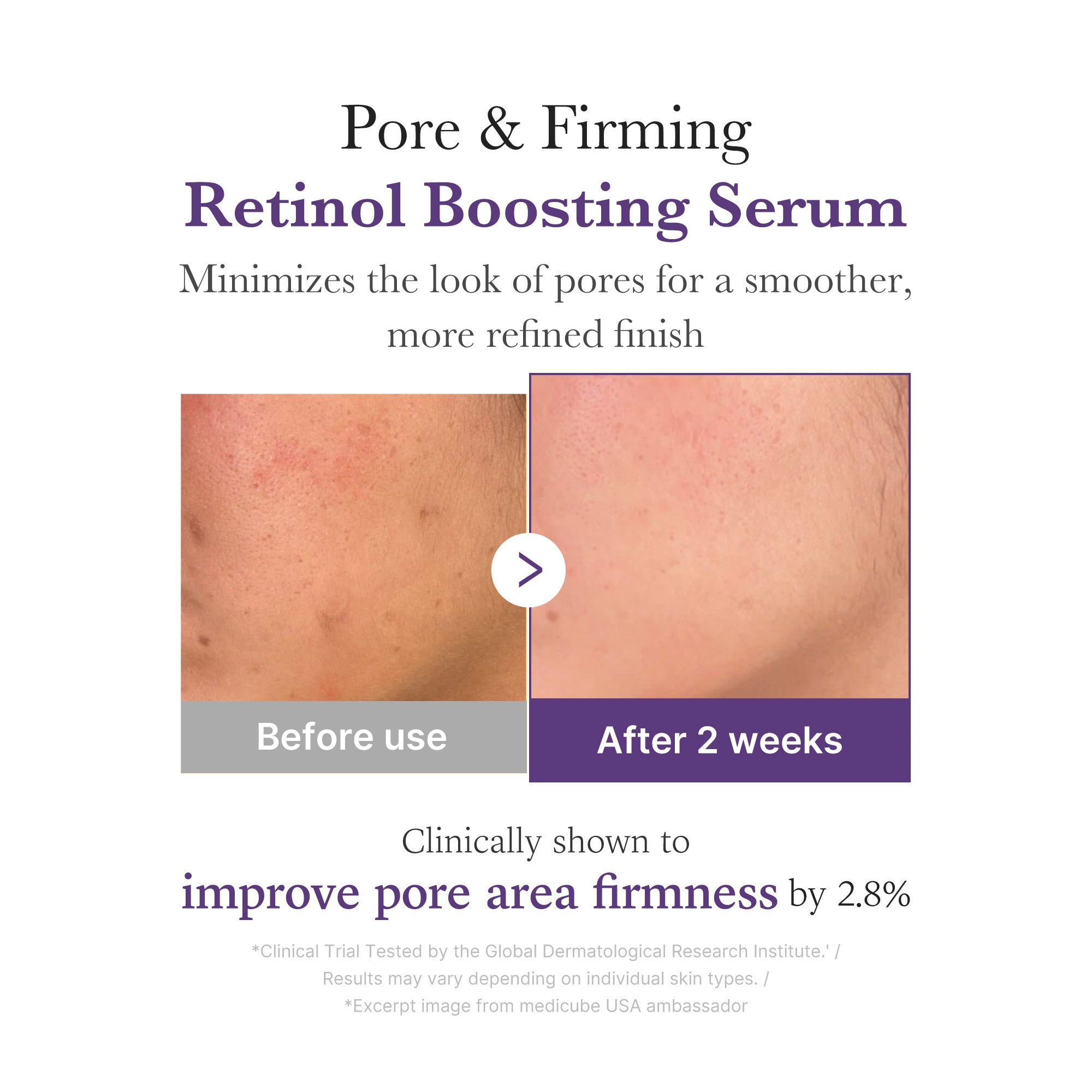 Retinol NMN Boosting Serum Y8