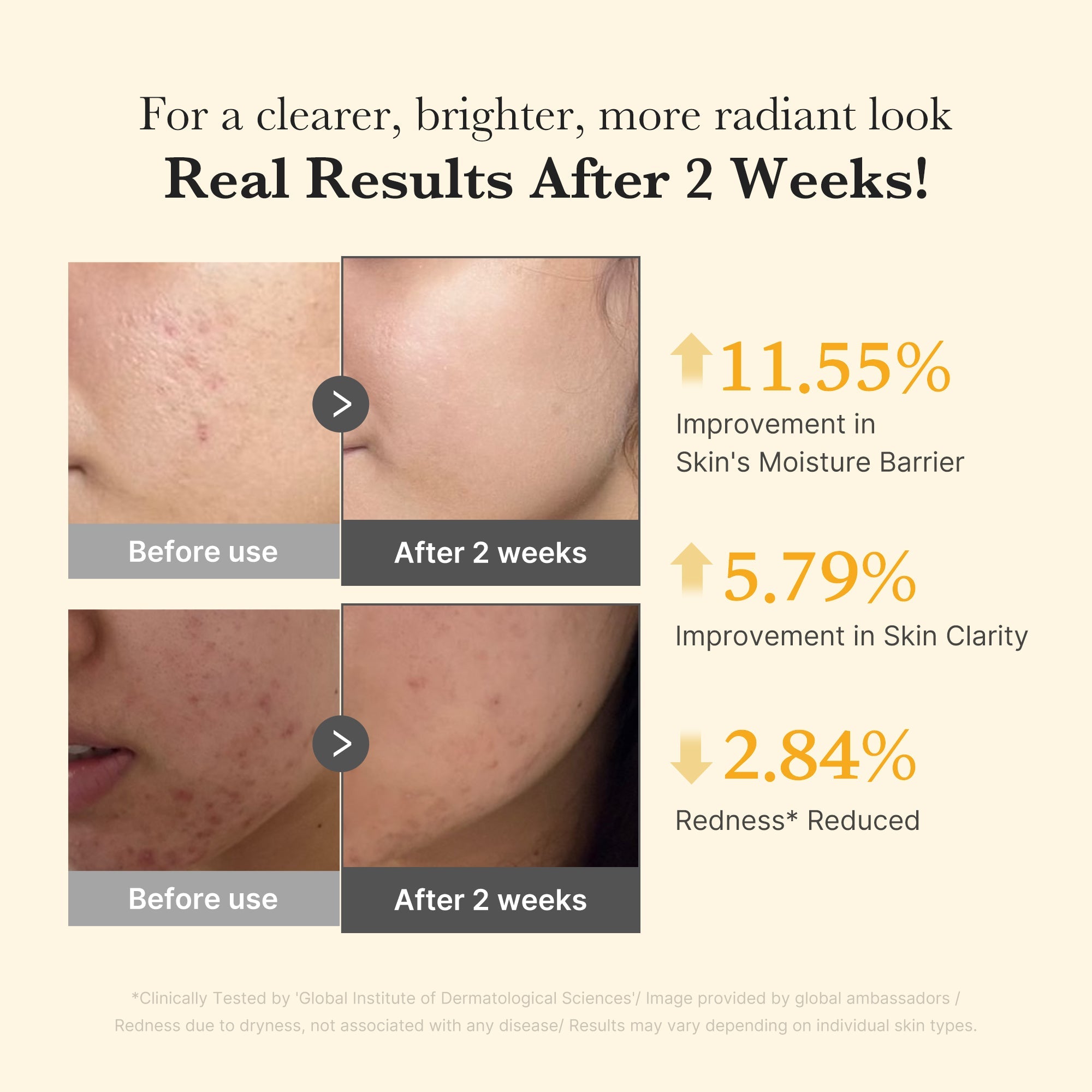 Kojic Acid Turmeric Capsule Serum W5