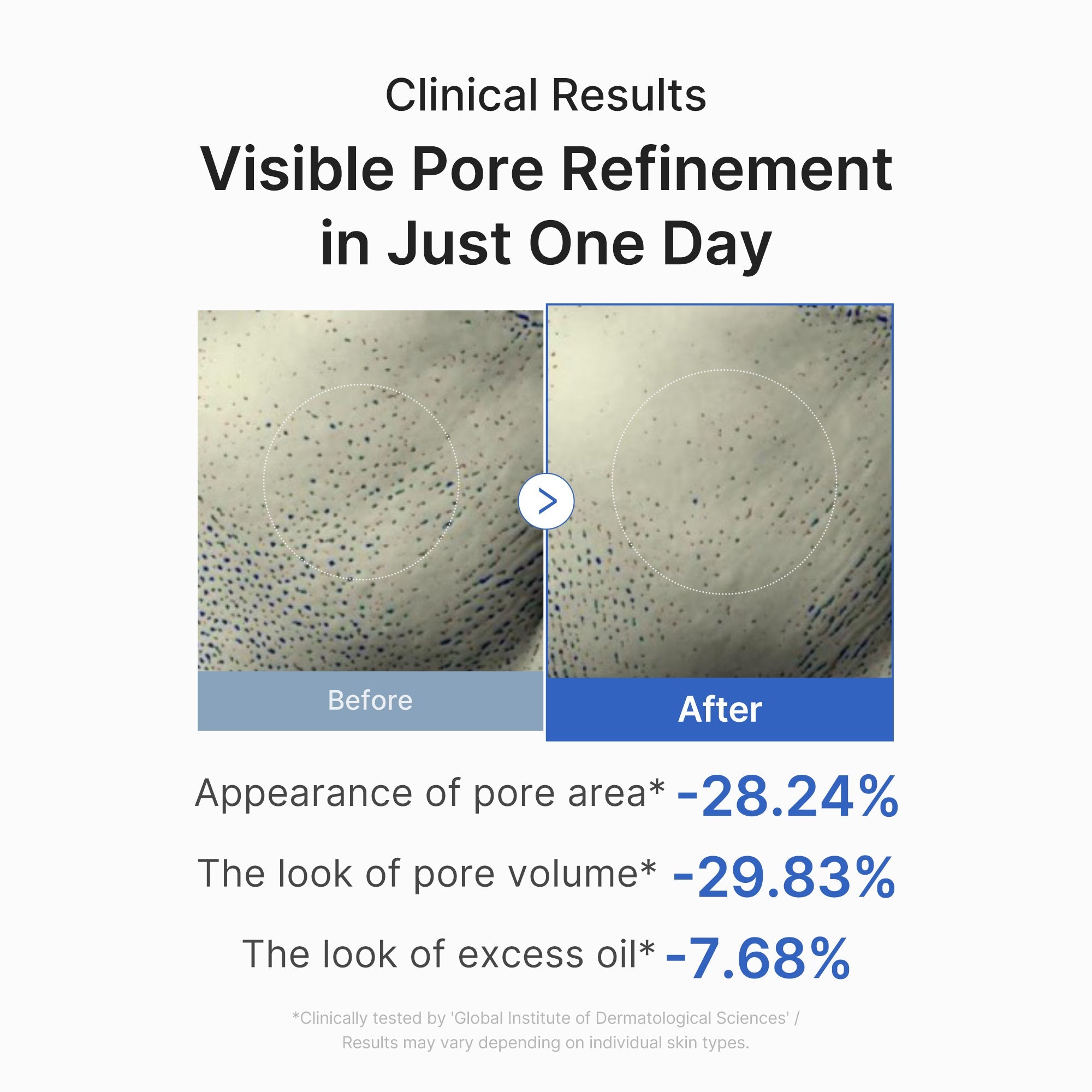 Zero Pore One-day Peptide Serum J2