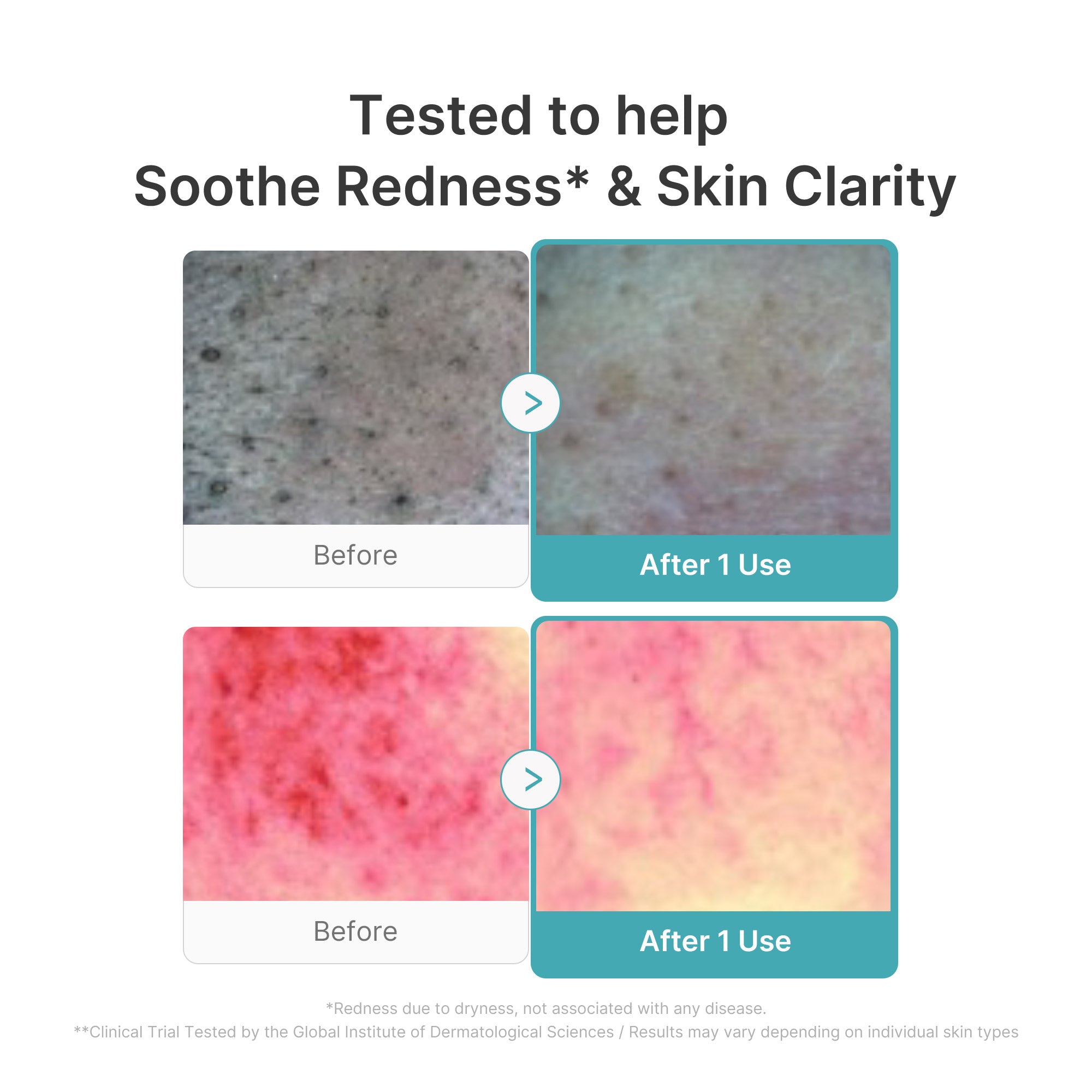 Azelaic Acid Capsule Foam Cleanser C3