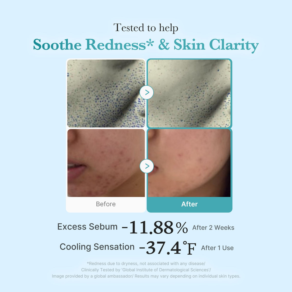 Azelaic Acid Niacinamide Clarifying Toner P0