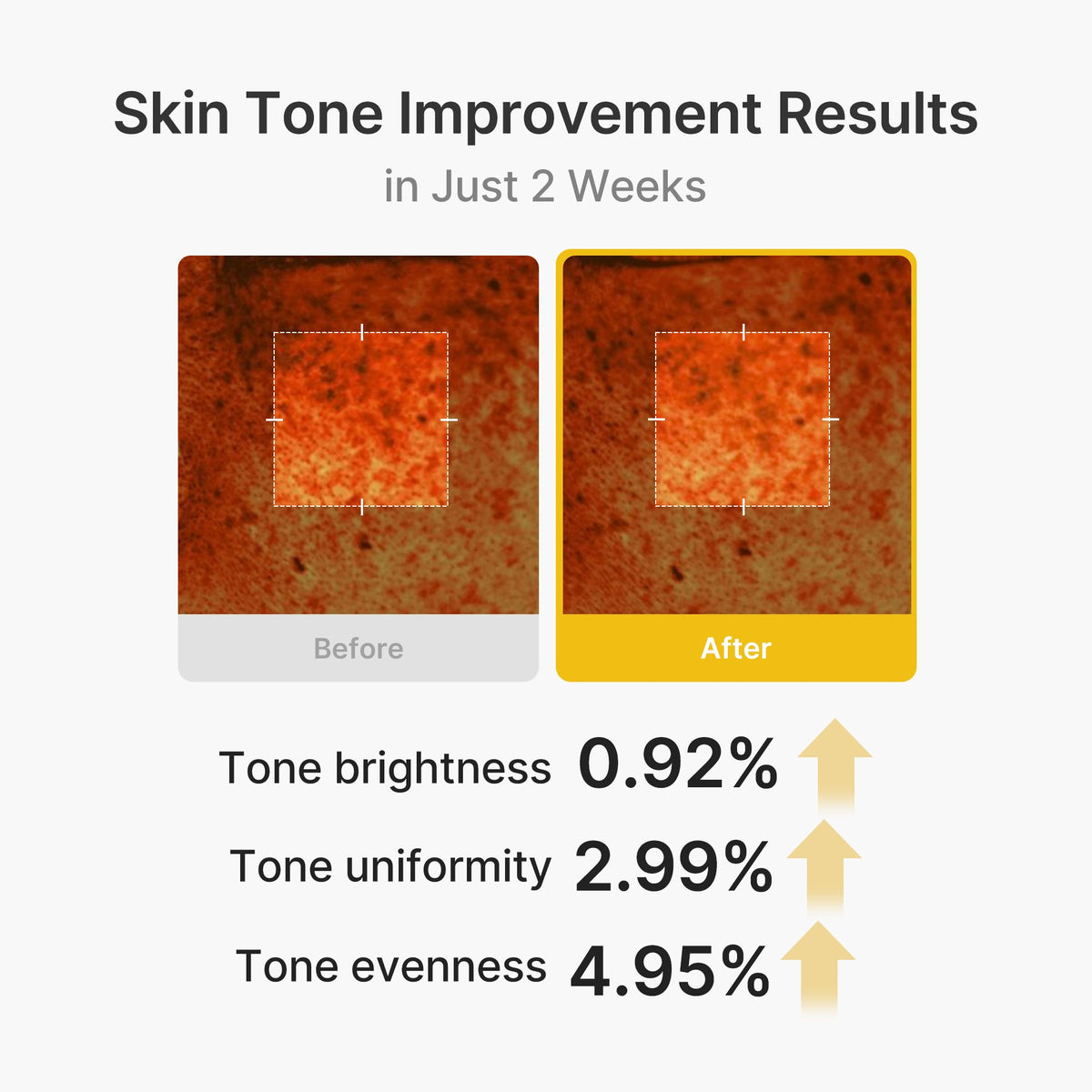 Kojic Acid Turmeric Vita Capsule Cream A9