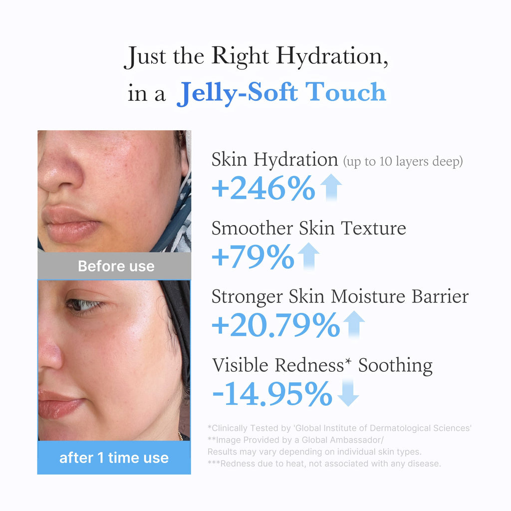 Hyaluronic Ceramide Moisturizing Jelly Cream V7