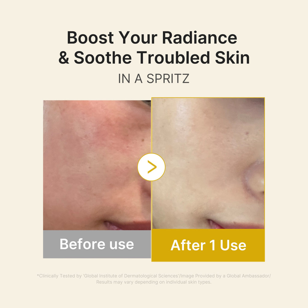 Kojic Acid Turmeric Vitamin Gold Jelly Mist Serum E9