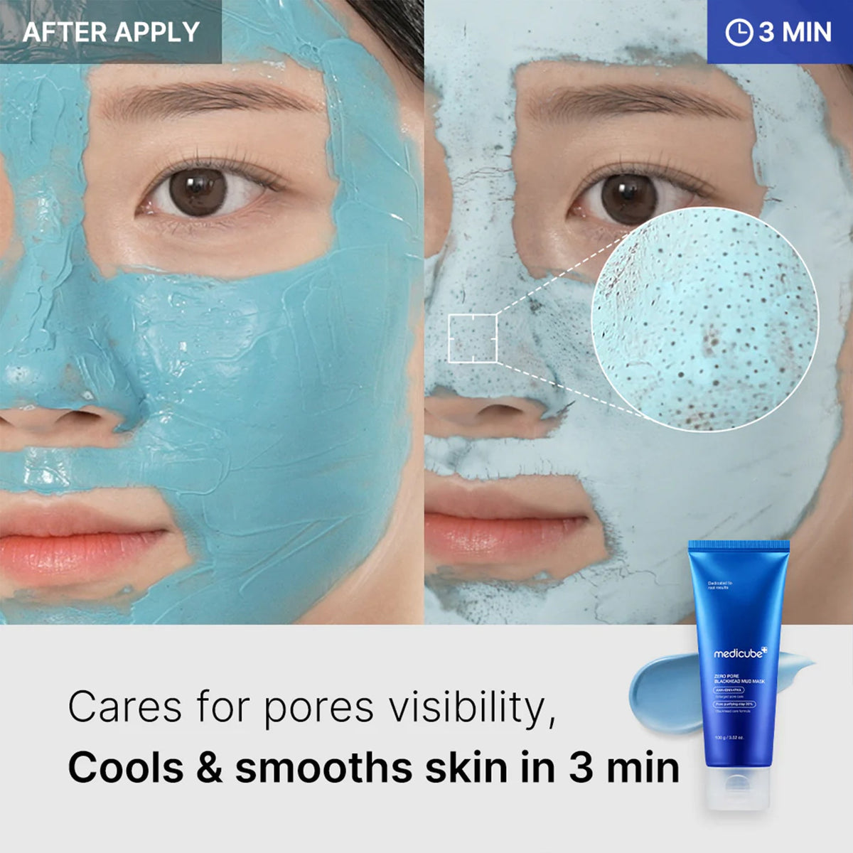 Zero Pore Blackhead Mud Mask F5