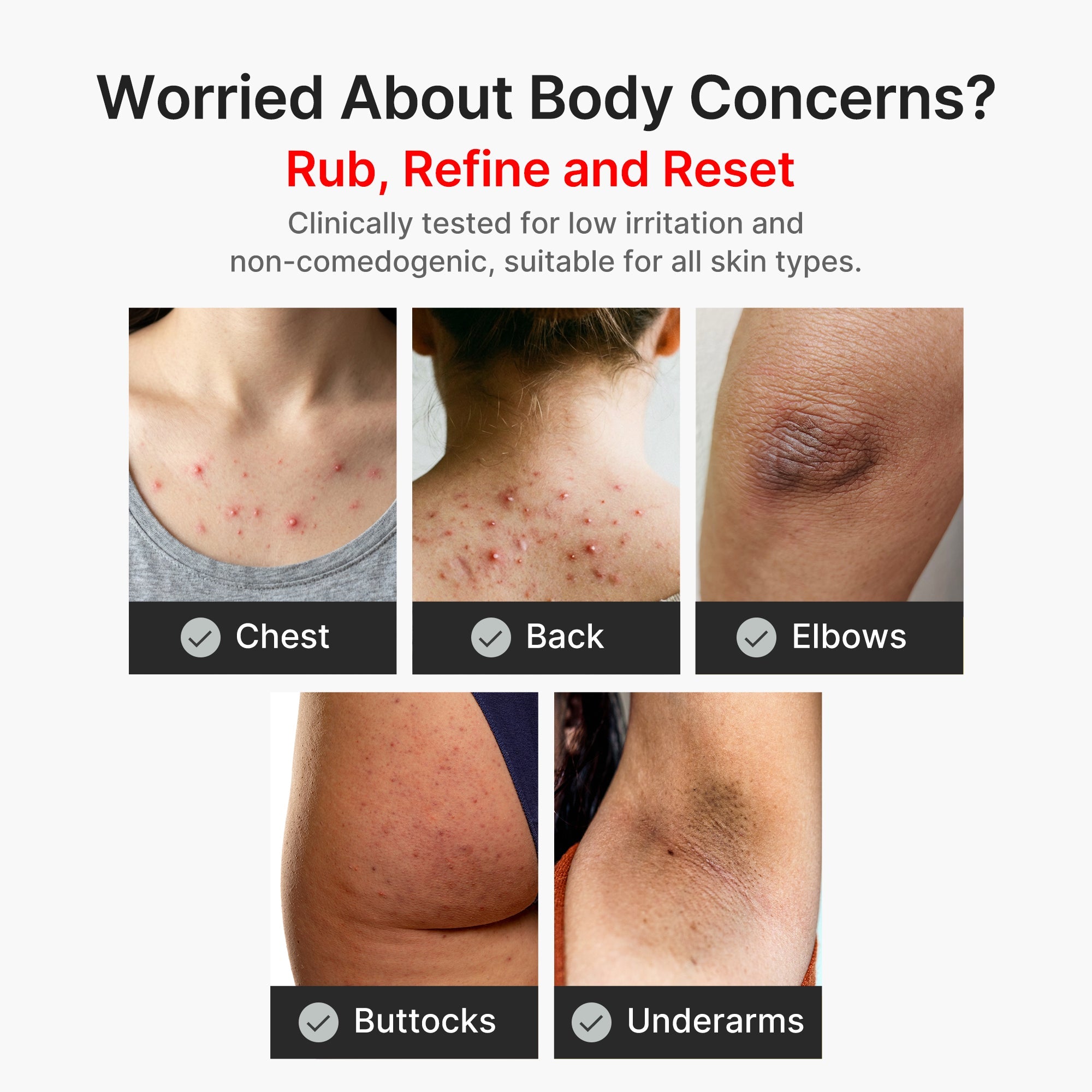 Kojic Acid Turmeric Body Peel Shot Q6