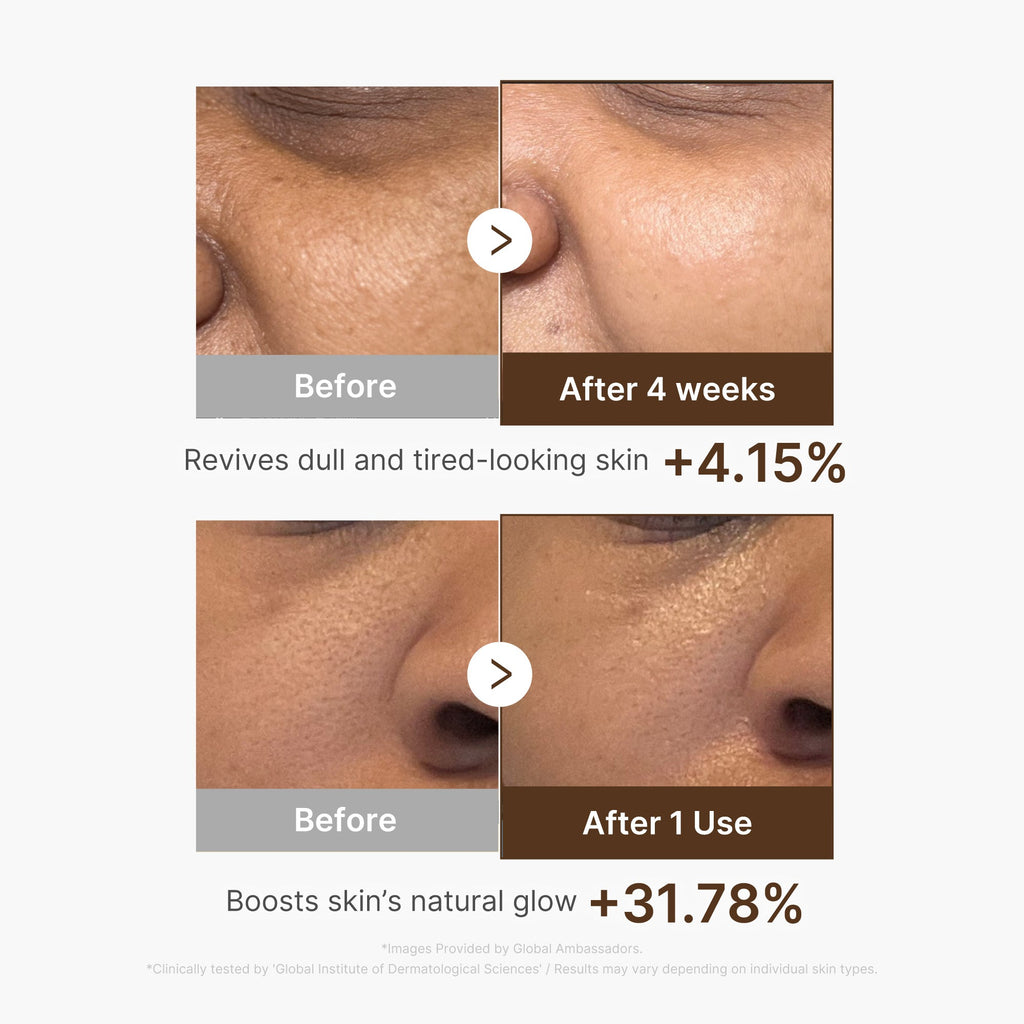 Deep Vitamin C Capsule Serum Q7