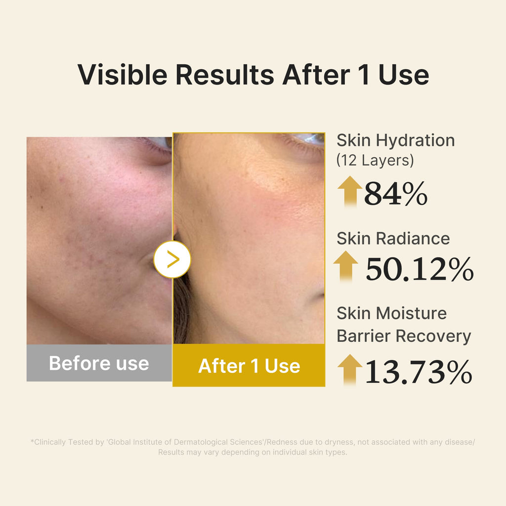 Kojic Acid Turmeric Vitamin Gold Jelly Mist Serum E9