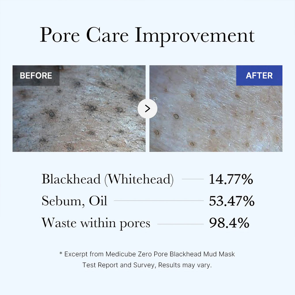 Zero Pore Blackhead Mud Mask F5