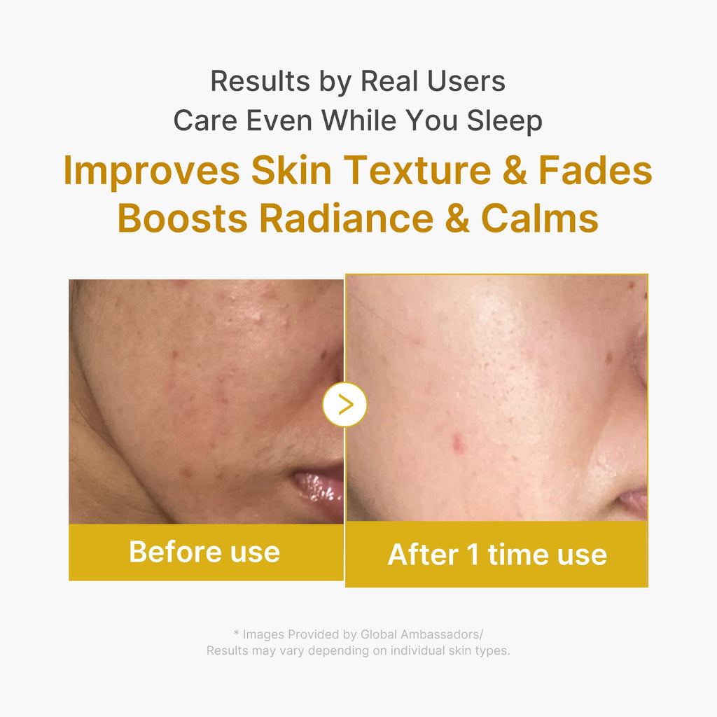 Kojic Acid Turmeric Overnight Wrapping Mask N9