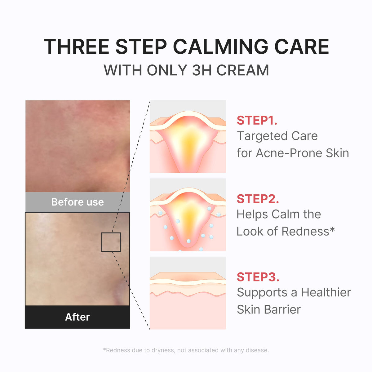 3H Daily Relief Cream X0