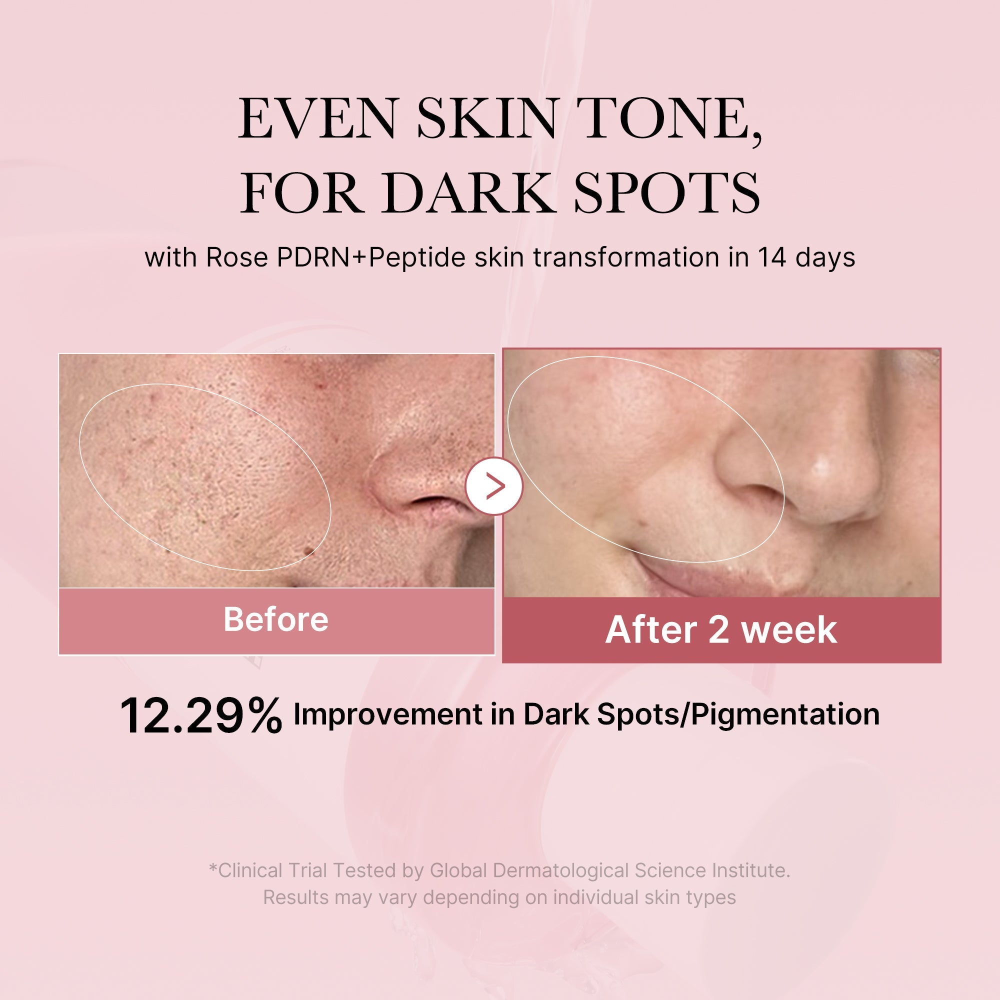 PDRN Pink Peptide Toner C3