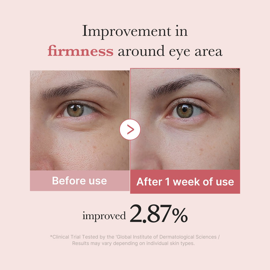 PDRN Pink Peptide Eye Cream K3