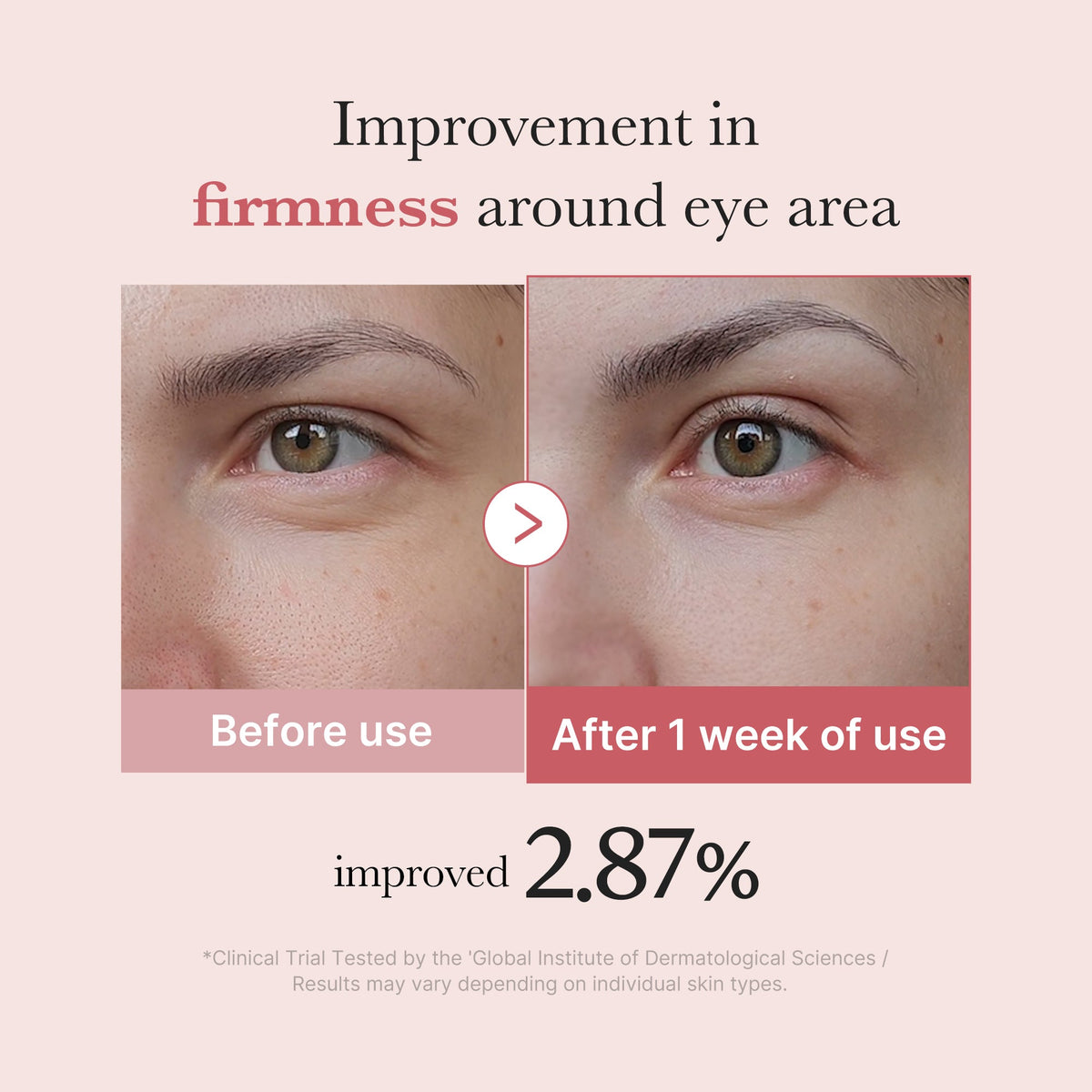 PDRN Pink Peptide Eye Cream K3