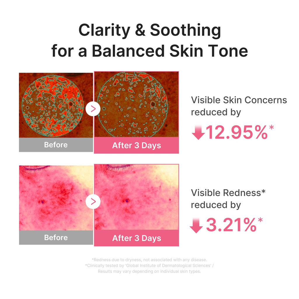 Ultra Light PDRN Pink Peptide Serum H2
