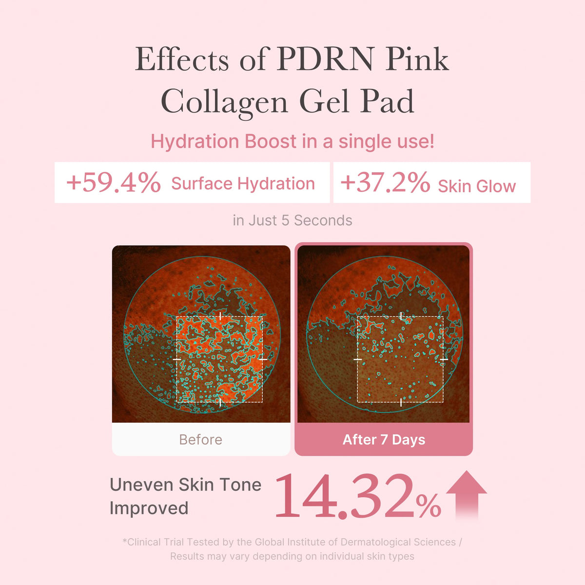 PDRN Pink Collagen Gel Toner Pad Q5