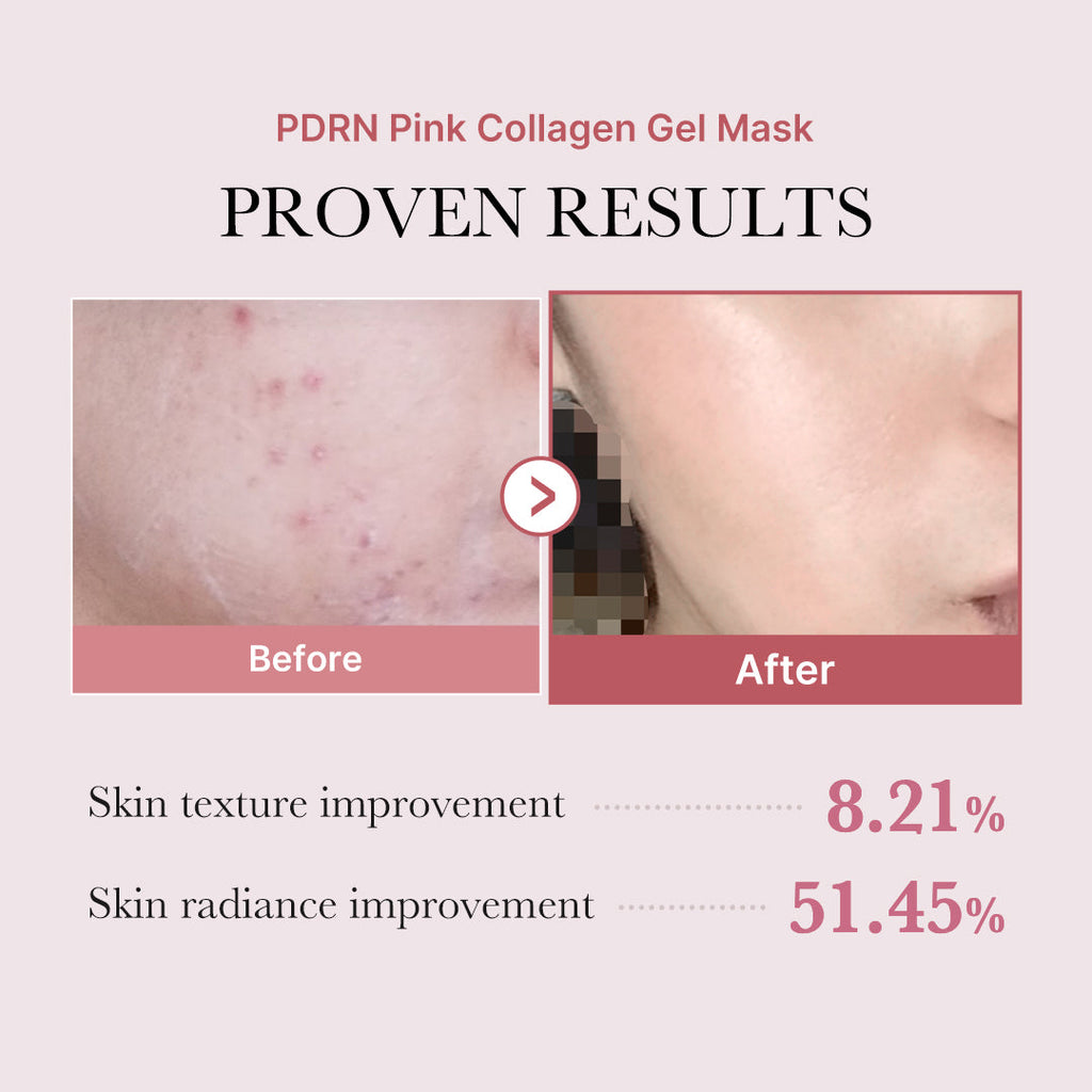 PDRN Pink Glow Full Set K8