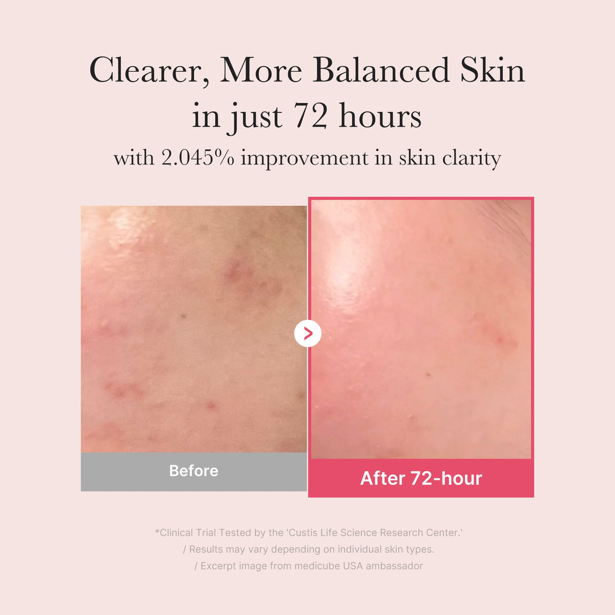 TXA Niacinamide Serum Y8
