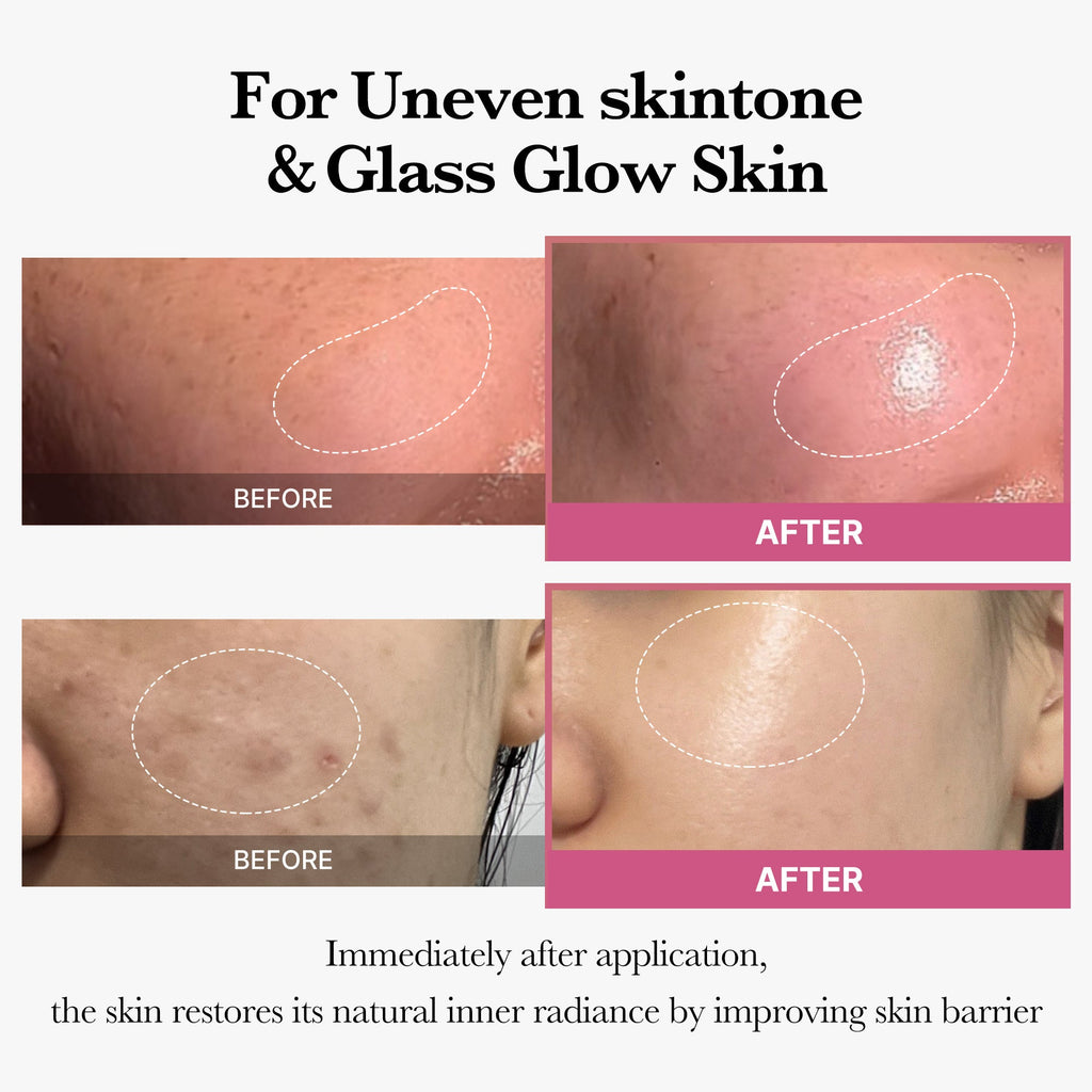 [Tati's Exclusive] All About Glow Set K5